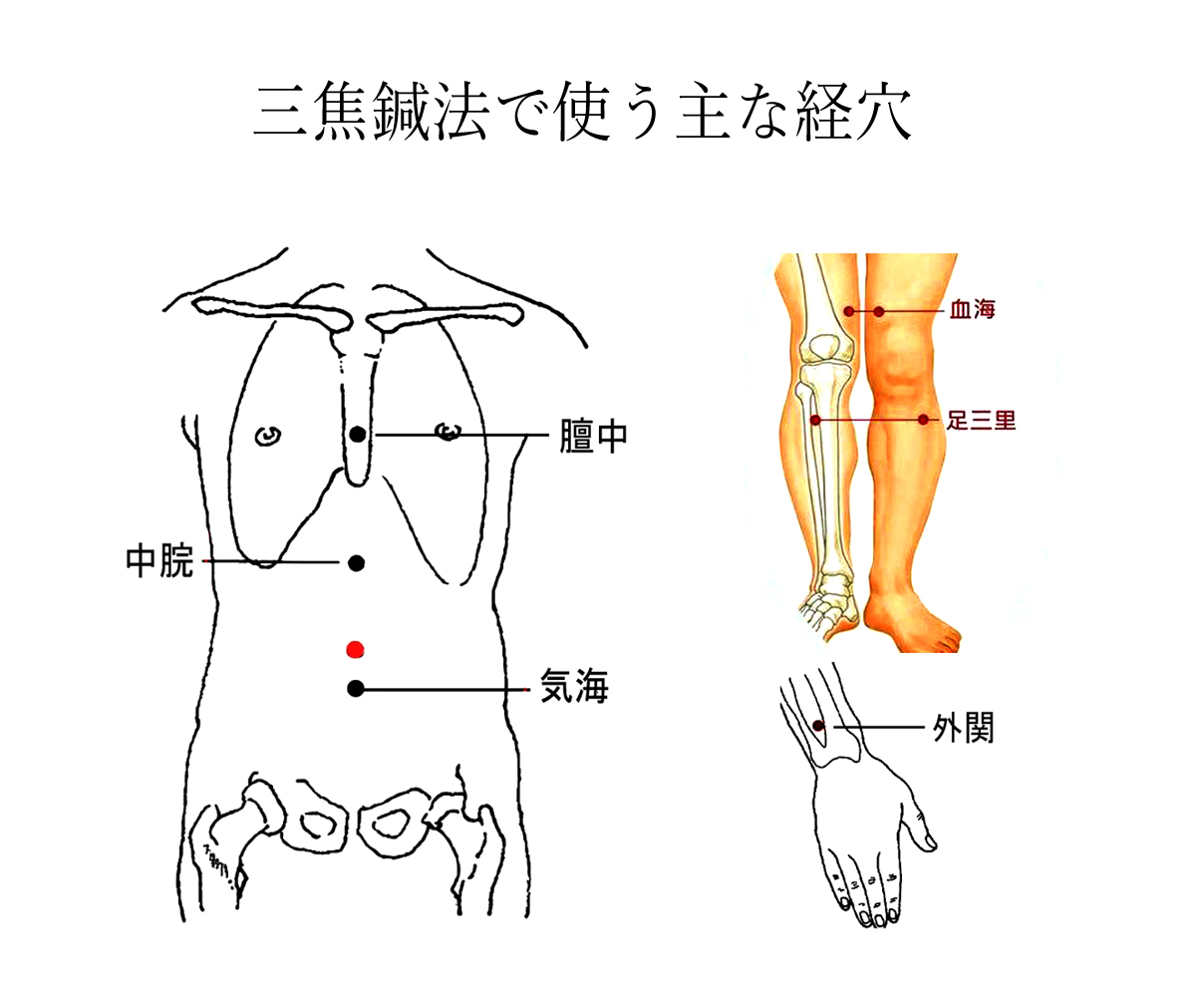 三焦鍼法で使う主な経穴